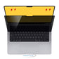 16" LCD Privacy Protector For Lenovo/Hp/Dell/Acer/Asus/Thinkpad/Envy/Xps/Toshiba